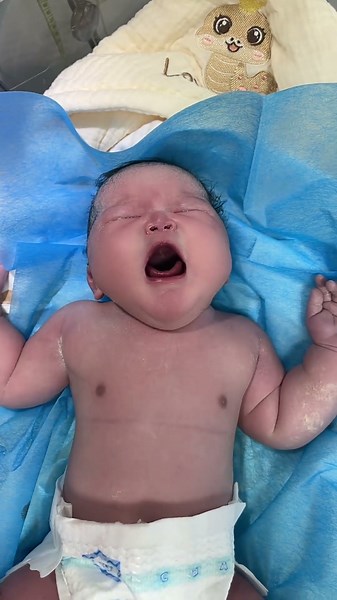 Clinical Assessment of Newborn Subcutaneous Tissue & Birth Weight #newborn #care