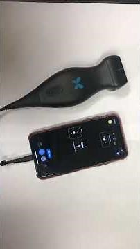 Butterfly IQ probe...starting it up.