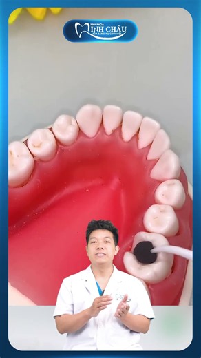 Bạn Đánh Răng Rất Kĩ Nhưng Vẫn Sâu Kẽ Răng? | Nha Khoa Minh Châu