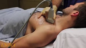 LSORA: US guided PECS II (2) Block
