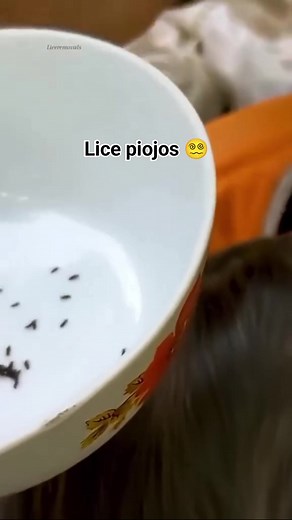 21K views · 206 reactions | Piojos ‍ #lice #ticks #piojos #trypophobia #parasites | Lice Piojos Ticks | Facebook