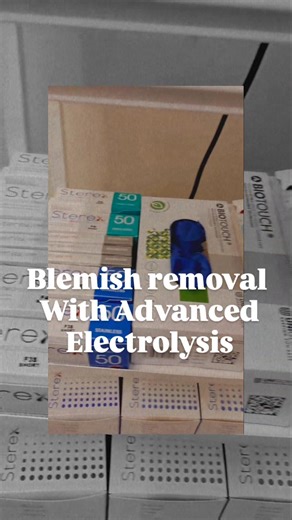 ✨ Blemish Removal, Redefined ✨ Here’s what Advanced Electrolysis can treat — in minutes, not months: 🔹 Facial Thread Veins 🔹 Spider Naevi 🔹 Cherry Angiomas 🔹 Skin Tags 🔹 Milia These common skin concerns don’t have to be permanent. Quick, precise, and with minimal downtime. Ready to see the difference? 💥 Now booking 50% OFF model appointments — limited availability! 📍Blemish removal advanced electrolysis in Luton 📲 Go online or call 01582 652299 to claim your slot! #BlemishRemoval #Advanc