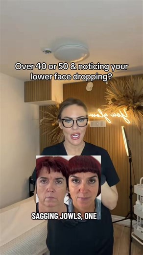 Understanding Lower Face Ageing: Muscle Dynamics Explained