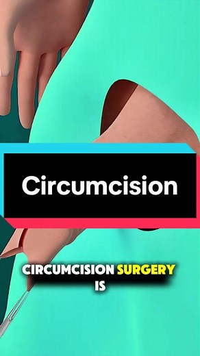 Understanding Circumcision Surgery Techniques