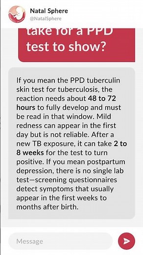 How long does it take for a PPD test to show?