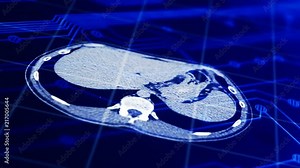 MRI and CT technology concept. Scanning process. X-ray emitting