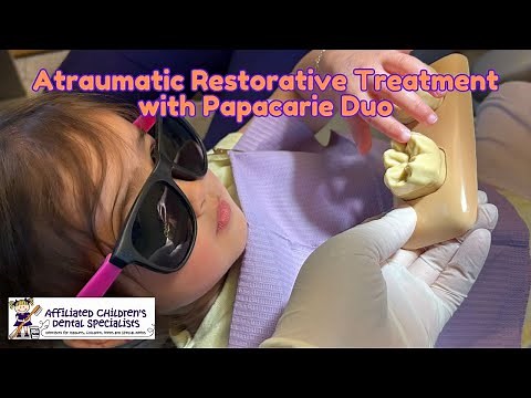 Atraumatic Restorative Treatment (ART) with Papacarie Duo and EQUIA Forte; Painless Cavity Filling