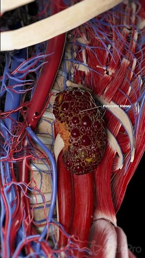 World Kidney Day 2026 | Kidney Anatomy: Healthy, Horseshoe, Cross-Section & Polycystic