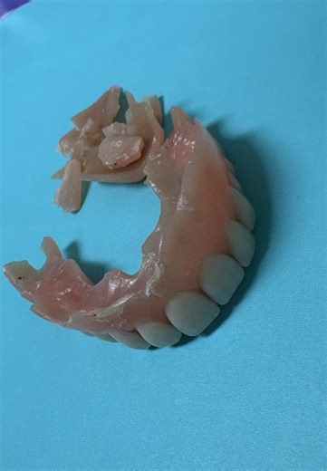 Store your dentures or removable appliances in an area your animals can’t reach, especially dogs. They’re just obsessed with your smell… and saliva 😂 #dentalhumor #dentures #viral #dentistry #baddog