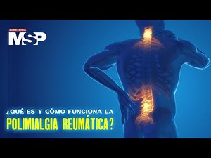 What is polymyalgia rheumatica and how does it work? - #MSPExclusive