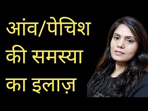 Aav ki bimari ka ilaj. Pechish ki dawa. Aav ka ilaj. Aav ka gharelu ilaj. Pechish ka gharelu ilaj