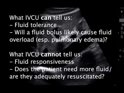 Assessment of Fluid Resuscitation by IVC Ultrasound