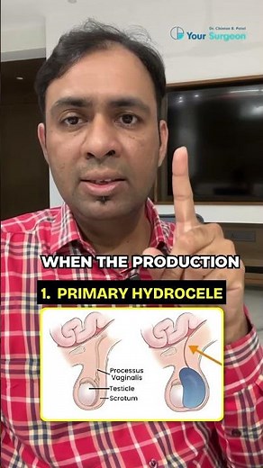 हायड्रोसिल क्या है ? कारण ? hydrocele kya hai ? Kyun hota hai ? Reasons ? Hydrocil meaning