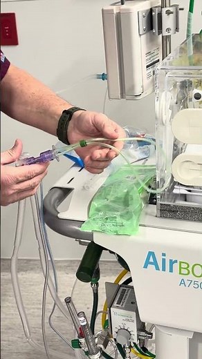 Adding RAM cannula to in house transport Crossvent2