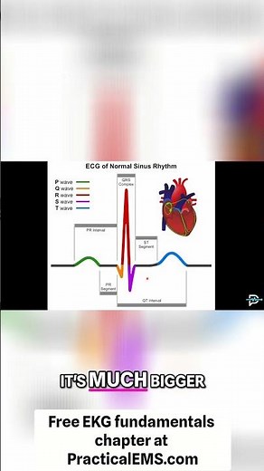 Understanding the Heart's Electrical System: A Visual Guide