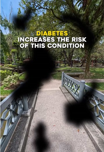 Diabetes and Your Eyes: Don't Let It Steal Your Sight