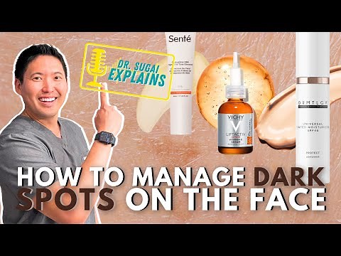 Dermatologist Explains: How to Manage Hyperpigmentation/Dark Spots on the Face