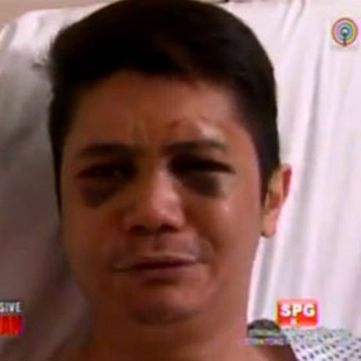 What you need to know about the Vhong Navarro bugbog incident | Coconuts