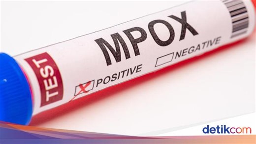 Skrining Mpox Juga Pakai Swab PCR, Pakar Jelaskan Cara Ambil Sampelnya