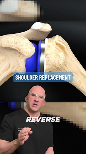 Bone Doctor - Joint Pain MD on TikTok