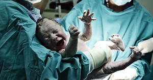 Skala Apgar - kiedy się stosuje? Czy skala Apgar jest wiarygodna?