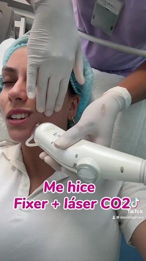 Fixer laser CO2 fraccionado ⚡️ para una piel mas tersa, de tono uniforme y linda 🥰 #laserco2 #laserco2fraccionado #fixer #cuidadodelapiel #danigrows #fyp