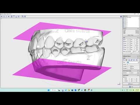 How to Label steps with Onyx Ceph