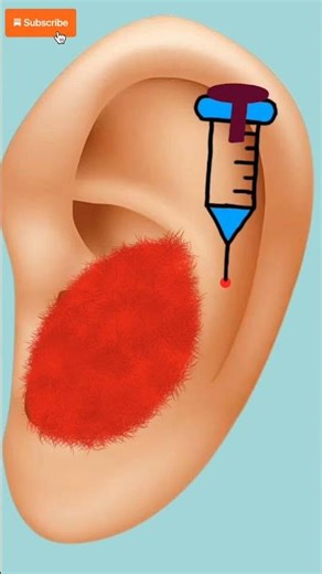 Cockroach in Ear While Sleeping | Real Treatment #asmr #animation #shorts#toonfixasmr