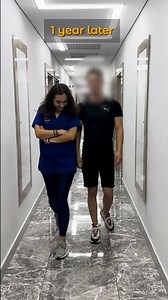 From 170 cm to 178 cm: Leg Lengthening Surgery Recovery Update