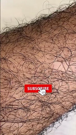 Hairy Legs with Meenal