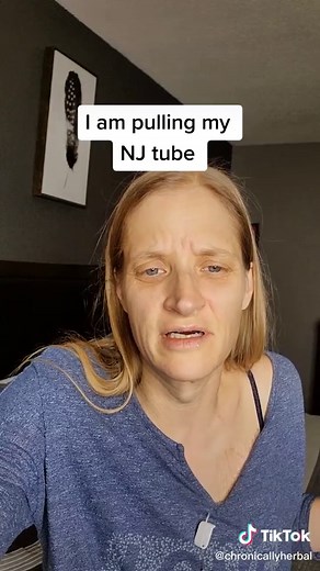 NJ Tube Removal: A Step-by-Step Process