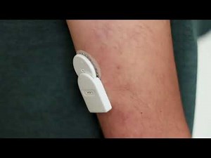 Using the Freestyle Libre with Miaomiao to get realtime glucose data on your Apple Watch
