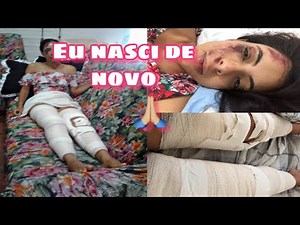 TUDO SOBRE MEU ACIDENTE DE MOTO / EU NASCI DE NOVO
