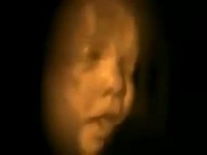 6.4K views · 270 reactions | This incredible scan captured footage of what unborn babies do in the womb. Wow! This is amazing. https://www.lifenews.com/2019/02/04/incredible-video-shows-unborn-babies-jumping-around-waving-yawning-and-sucking-their-thumb/ | LifeNews.com | Facebook