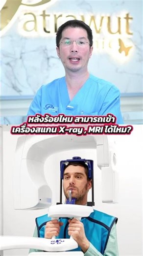 🪡 Can thread lifts be put through an X-ray machine or scanner? #ThreadLifting #FishboneThreadLifting