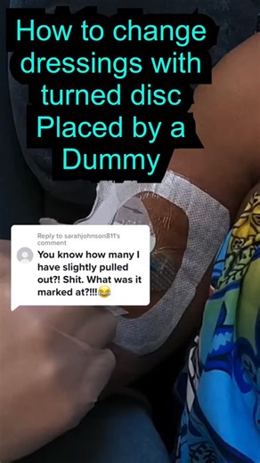 TheVascularGuy on Instagram: "patient - how to undress bad discs.mp4"