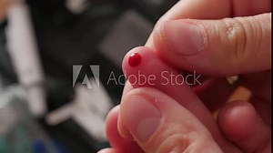 finger pricking to measure blood glucose, smearing blood on finger