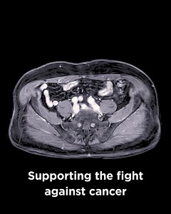 Two years ago, Bruce Power became the first commercial nuclear operator to produce lutetium-177, a cancer-fighting isotope, through an innovative Isotope Production System (IPS) and an international collaboration with Saugeen Ojibway Nation (SON), Isogen (a Kinectrics and Framatome company) and ITM Isotope Technologies Munich SE (ITM). Read more about these initiatives here: https://tinyurl.com/fe3hrj7t #lutetium177 #isotopes #medicalinnovation #brucepower | Bruce Power
