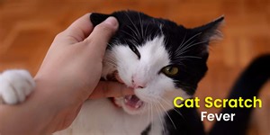 All You Need To Know About Cat Scratch Fever: Symptoms, Causes, Treatment, Diagnosis, Prevention