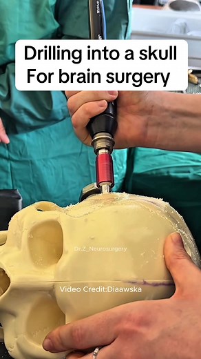 This is how we drill into the skull for brain surgery. #medical #doctor #neurosurgery #meded #medtok