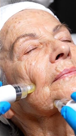 “Smart Vacuum Deep Clean 💨 | Ultra Realistic ASMR Skincare”