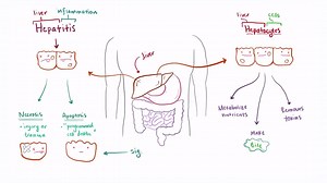 2.7K views · 76 reactions | What is hepatitis? | World Genetics | Facebook