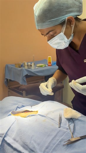 Infected sebaceous cyst removal