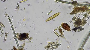 Diatom Water Microorganisms Under Microscope Australia Stock Footage Video (100% Royalty-free) 1108399389 | Shutterstock