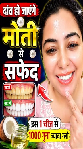Teeth Whitening Secret 😱 दांत बनेंगे मोती जैसे सफेद Overnight!