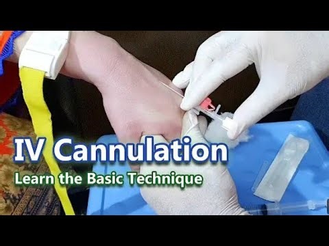 कैनुला कैसे लगाएं // how to insert iv cannula ///