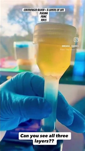 PBMC extraction from whole blood. #science #research #biology #immunology #phd #lab #experiment