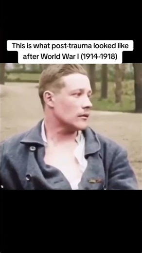 This is what post-trauma looked like after World War I (1914-1918)