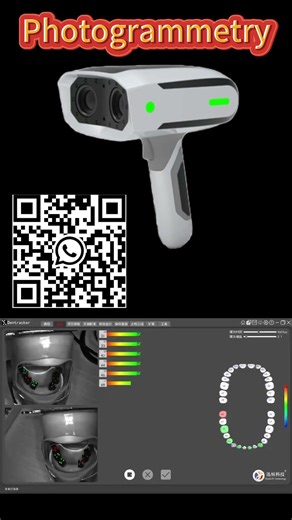What Is Dental Photogrammetry and Why It Matters for Full-Arch Implants #fullarchimplants