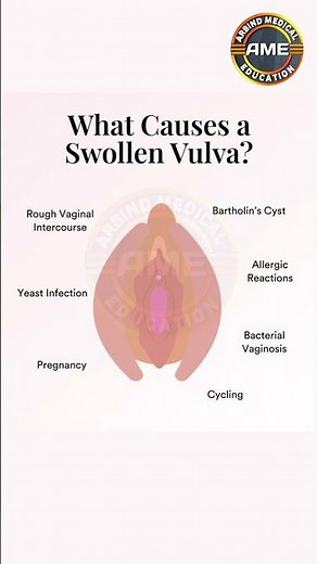 What Causes a Swollen Vulva? #arbindmedicaleducation